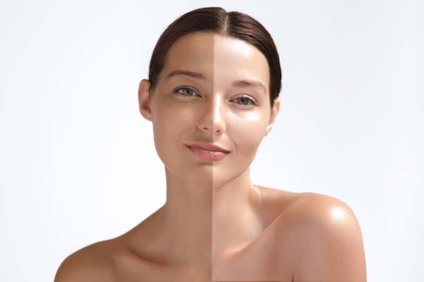 Skin Lightening