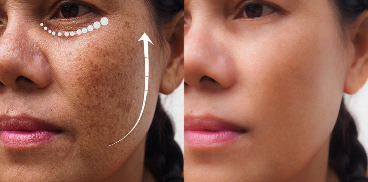 Anti-Pigmentation
